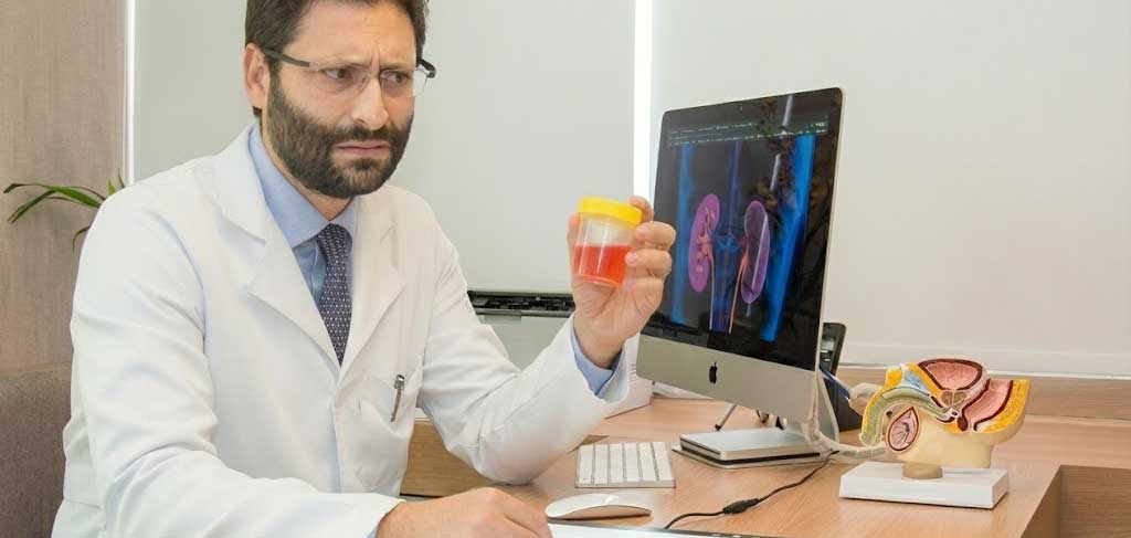 Urologista fala das possíveis causas do sangue na urina.