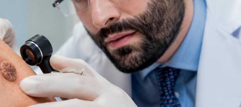 Tratamento de HPV: por que a verruga volta